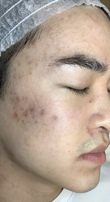 Trước